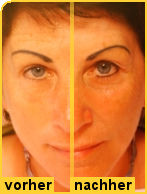 Permanent Make-Up Vor und Nach der Behandlung